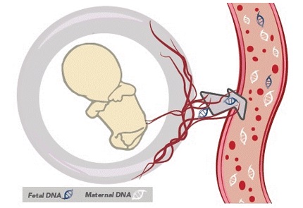 NIFTY Test มิติใหม่ของการตรวจโรคพันธุกรรมทารกในครรภ์