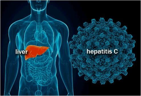 ไวรัสตับอักเสบซี (Hepatitis C Virus, HCV) ติดต่อได้อย่างไร และจะป้องกันอย่างไร