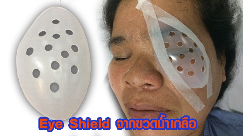 ประดิษฐ์ฝาครอบตา (Eye Shield) จากวัสดุที่เหลือใช้