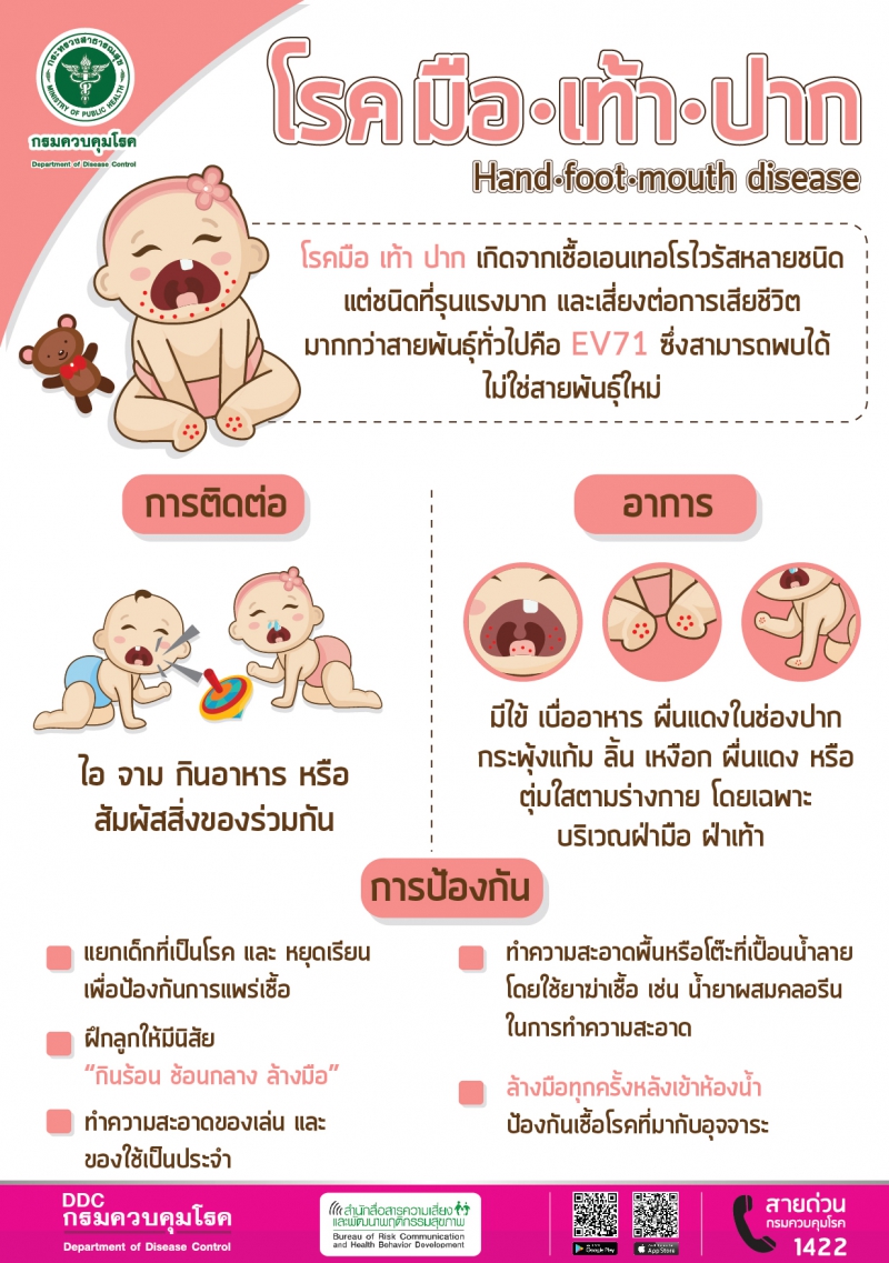 โรคมือ เท้า ปาก