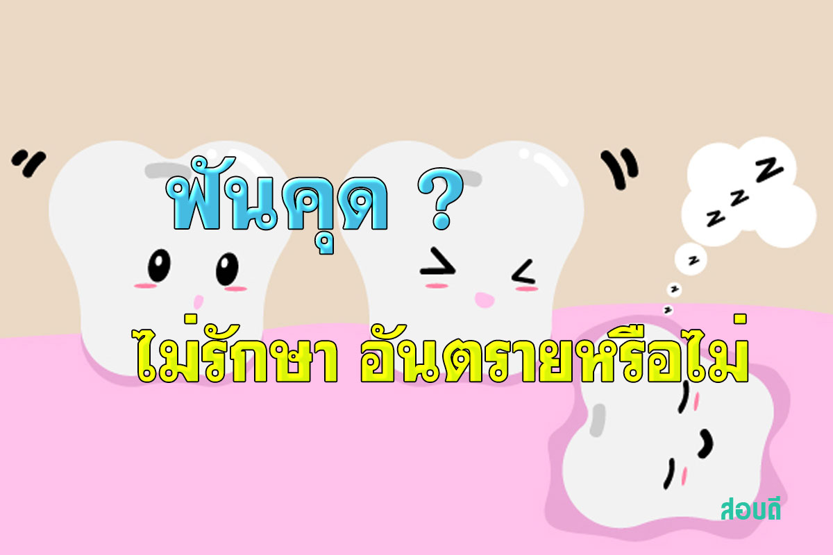 ฟันคุด ไม่รักษาเป็นอันตรายหรือไม่