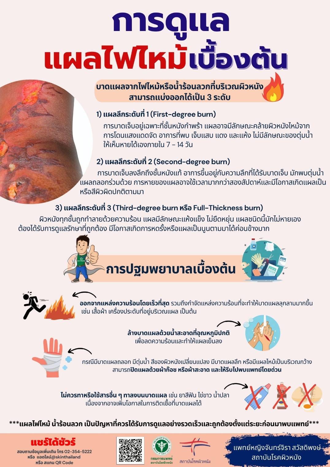 แพทย์ผิวหนังแนะนำแผลไฟไหม้ดูแลเบื้องต้นอย่างไรไม่ให้ติดเชื้อ